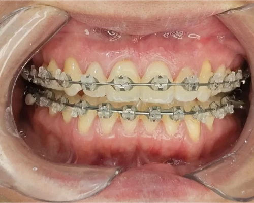 _cb0b014c_ce9d_4732_920a_65e5bbbeef94_1